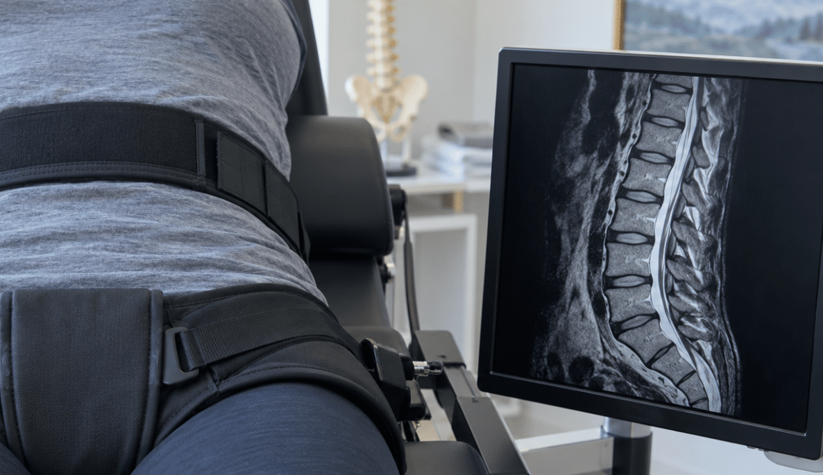 Spinal Decompression Therapy Covered By Insurance